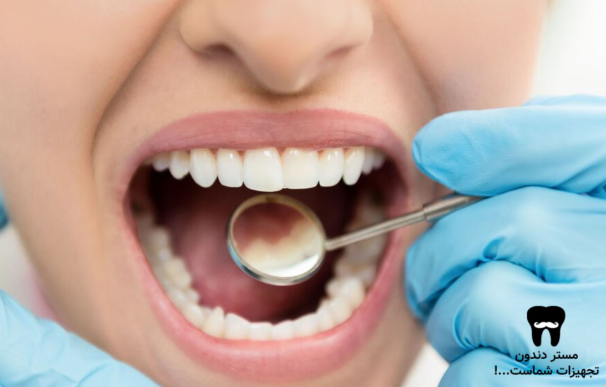آینه های دندانپزشکی-مستر دندون
